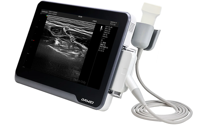 内置128GB固态硬盘（可扩展至 512GB），最多可存储 5000张图片
