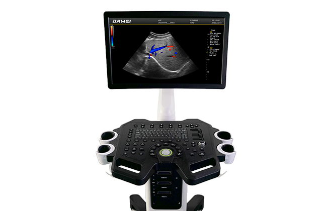 显示器可视角度更广