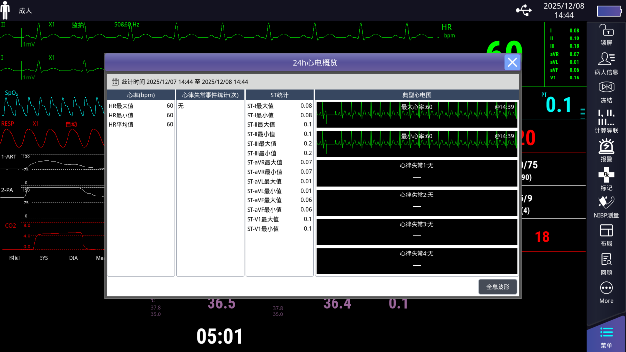 24h心电概览界面