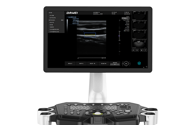 21.5 英寸医用超大屏幕