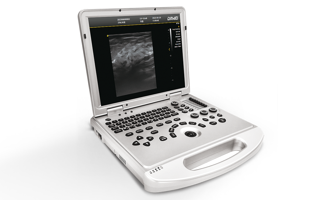 可选配远程超声会诊系统