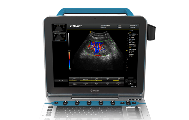 搭载15英寸全视角医用高清显示器