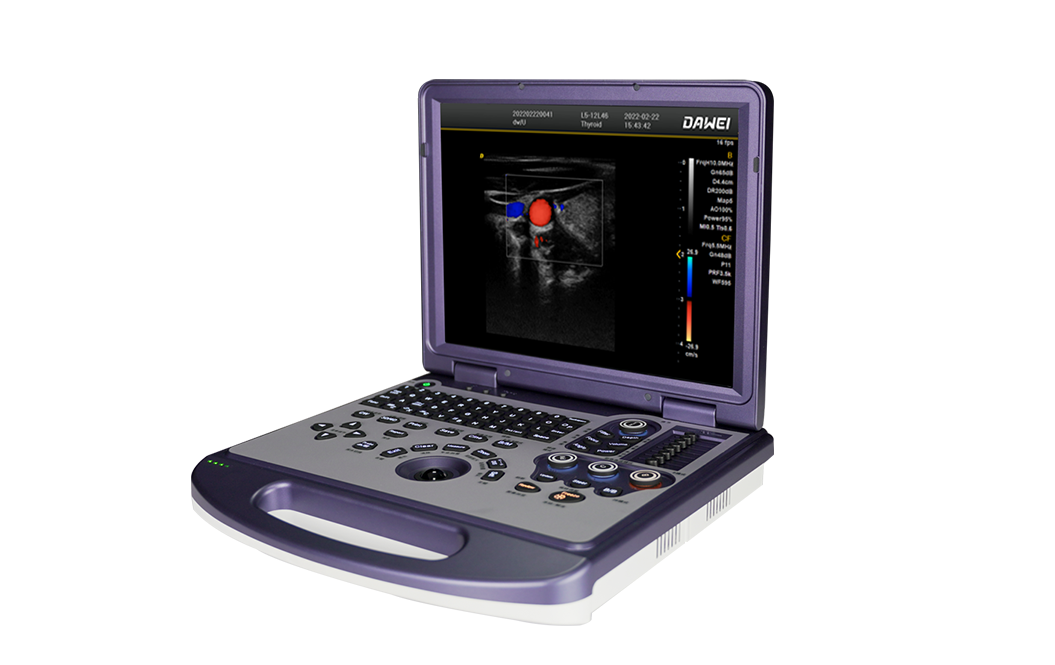 自主研发创新超声运行平台—“云海