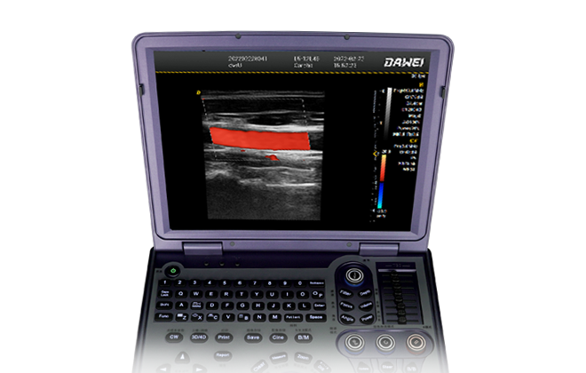 15英寸超清医用液晶显示器