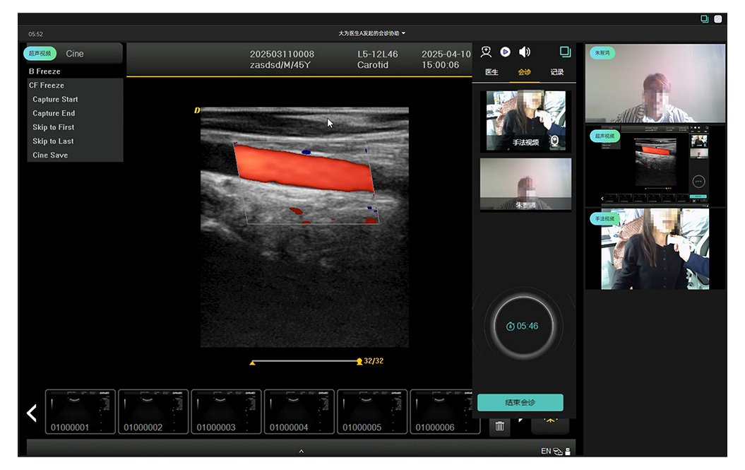 可选配远程超声会诊系统助力县域医共体建设